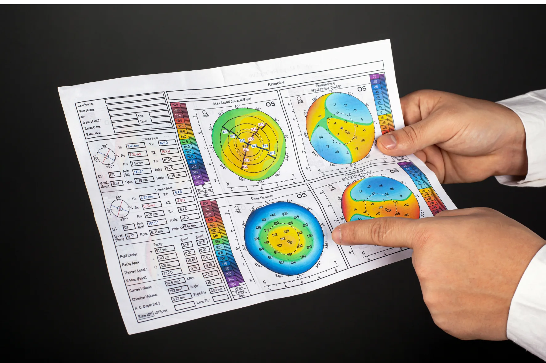 Resultado impresso de exame de topografia de córnea, com mapas coloridos de curvatura sendo segurado por um médico