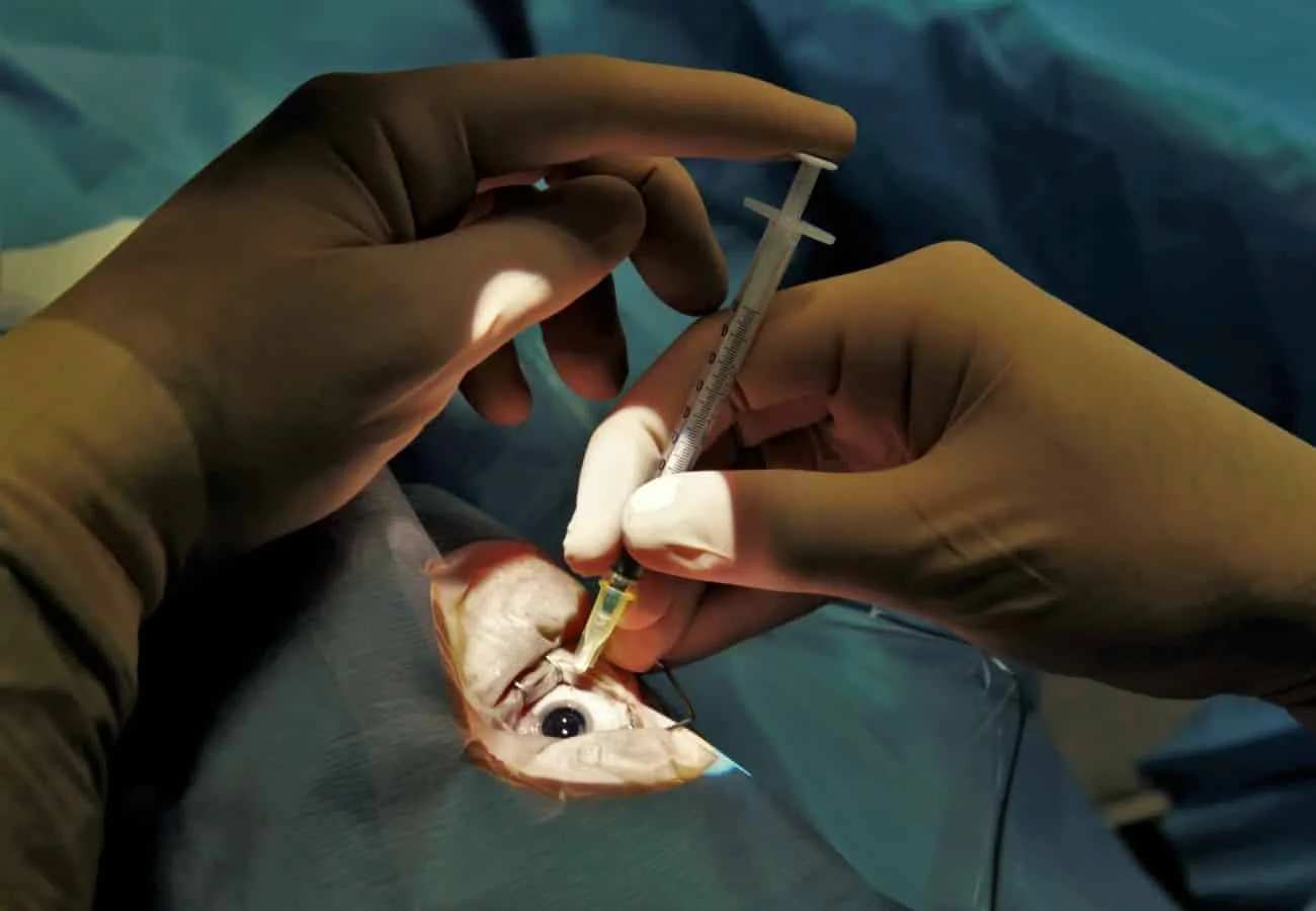 Foto real de um procedimento de injeção intraocular, aplicada na parte branca do olho
