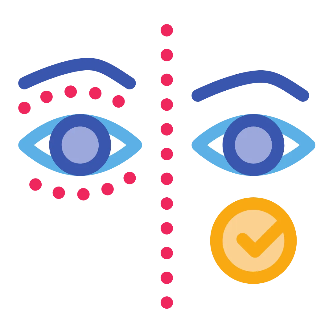 Ilustração de antes e depois de blefaroplastia