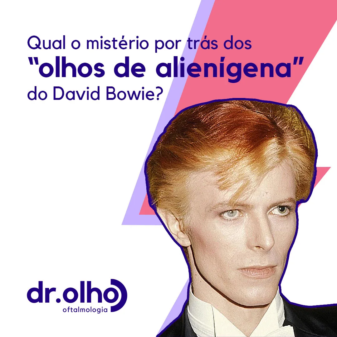 David Bowie com pupilas de tamanhos diferentes por anisocoria, dando a impressão de heterocromia nos olhos