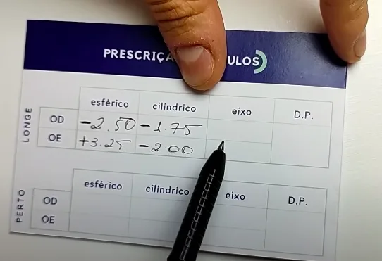 Exemplo de receita de óculos com grau cilíndrico, que sempre informa o grau do astigmatismo do paciente.